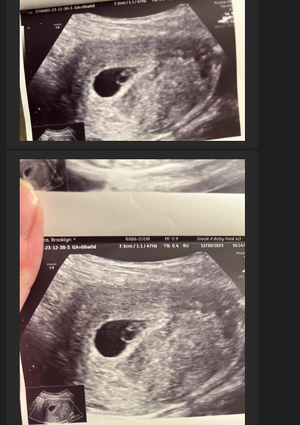 baby11.PNG