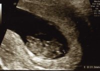 9wks (2).jpg