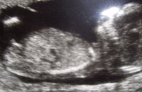 baby 4.jpg