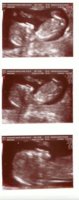 Baby Scan Pictures.jpg