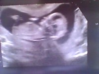 Snapshot_20110817.jpg