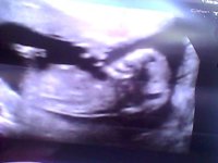 Snapshot_20110820_6.jpg