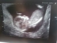 baby.jpg