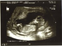 babyscan2.jpg