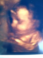IMG-20110910-00173.jpg