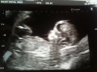 Baby.JPG