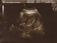 16 week scan 1.jpg