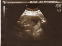 16 week scan 2.jpg