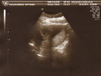 it's a .... BOY!!.jpg