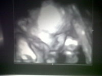 baby 32w4d.jpg