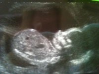 18wk + 5.jpg