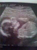 20 week2.jpg