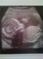20 week1.jpg