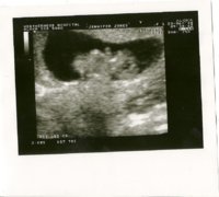 Sticky scan at 10 weeks 0 days 23rd June 2010.jpg