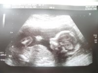20 week scan 2.jpg