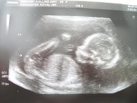 20 week scan 4.jpg