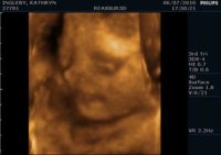 28weeks (4)r.jpg