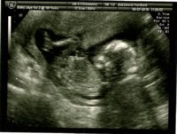 scan boy0001.jpg