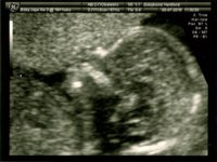 scan boy 10001.jpg