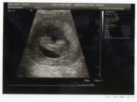 amys scan.jpg