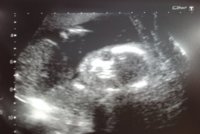 20wks.jpg