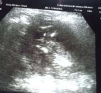 it's a girl!!.jpg