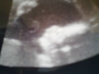 Boo Boo scan 23 weeks.4th November 2011 2.jpg