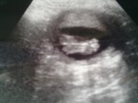 Boo Boo scan 23 weeks.4th November 2011 4.jpg