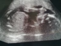 Boo Boo scan 23 weeks.4th November 2011 5.jpg