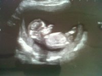 scan picture baby Hammond 2.jpg