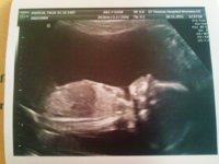 20 weeks 4 days.jpg