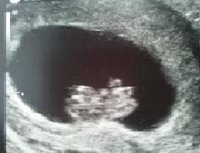 9+3 baby.jpg