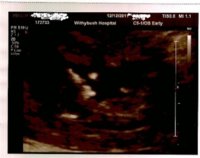 baby scan 1 13-12-11 001 (745x1024) (745x1024).jpg