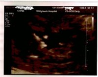 baby scan 1 13-12-11 001 (745x1024) (745x1024).jpg