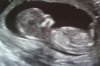 baby no.3.jpg