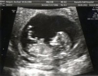 11 weeks and 6 days.jpg
