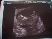 11 weeks 3 days.......JPG