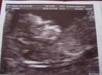 11 weeks 3 days.....JPG