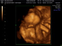 BABY PICTURES_1.JPG