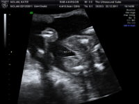 BABY PICTURES_7.JPG