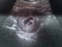 our little blob 6+4 edit.jpg