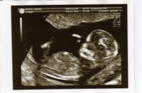 baby 301211a1.JPG
