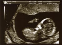 baby301211c1.JPG