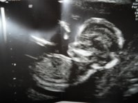 baby.jpg