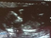 baby 2 pic 3.jpg