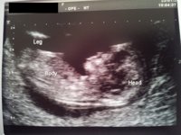 12wks 2days.jpg