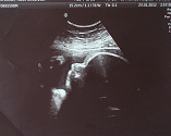 scan.png