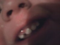 Extra tooth.jpg