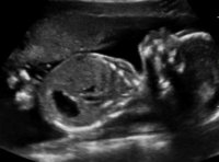Baby P.jpg