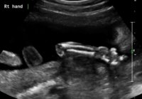 Baby P 2.jpg